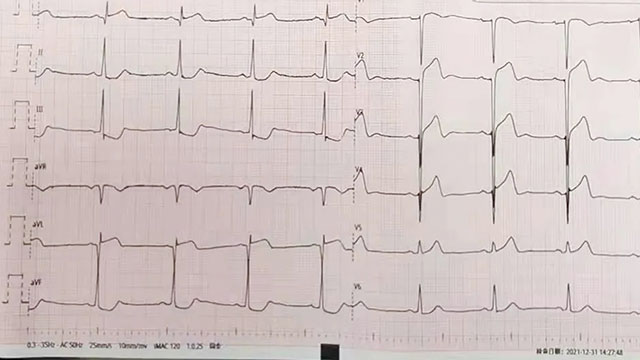 急、快、稳、准