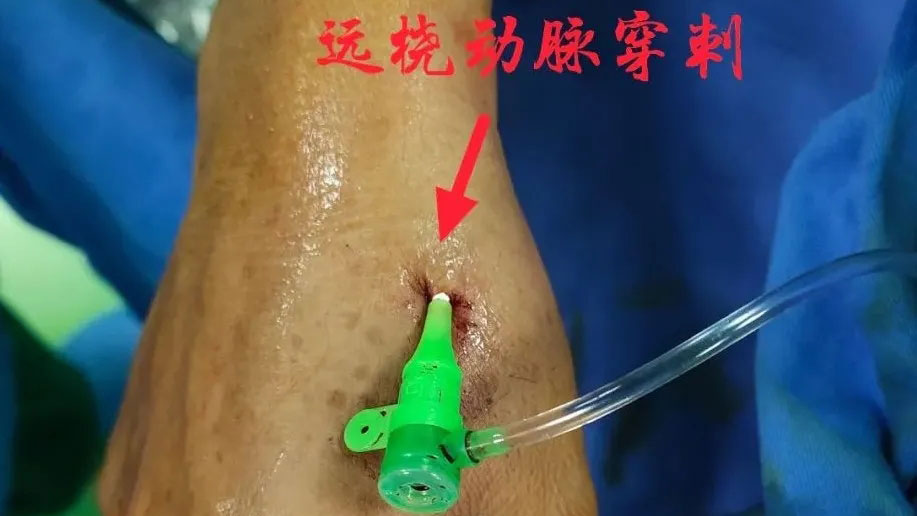 202201101047207075.jpg 2.webp.jpg