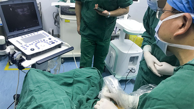 手术治疗也可“乳”此美丽