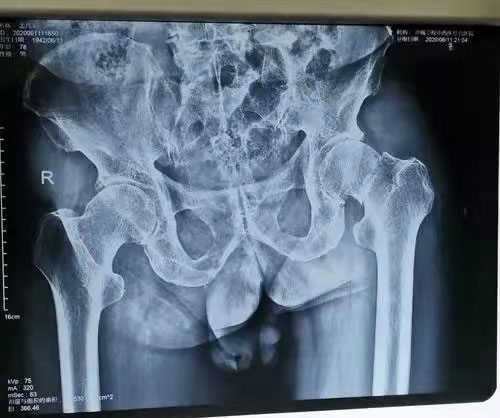 202203231000055520.jpg 202203231000055520.jpg