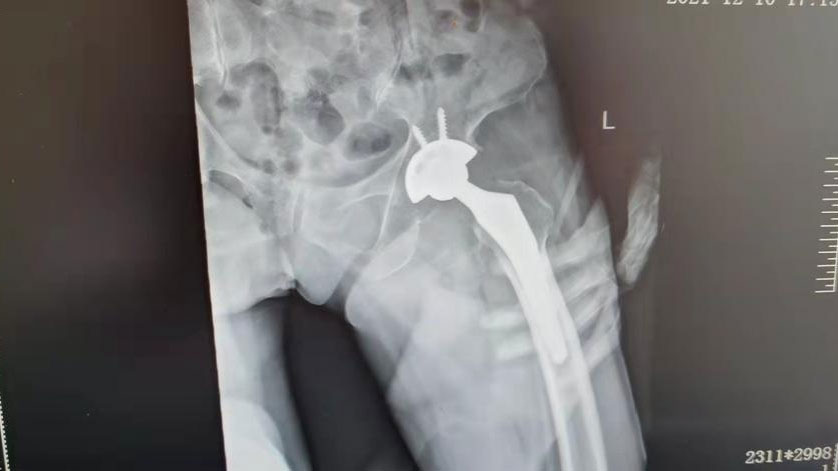 202203231000526070.jpg 202203231000526070.jpg