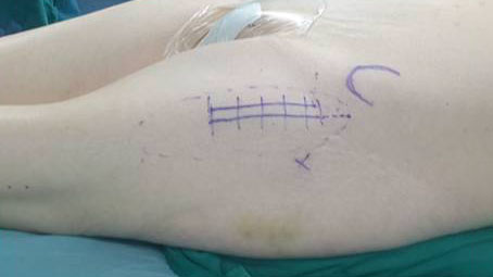 202203231001129617.jpg 202203231001129617.jpg