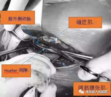 202203231002557670.png 202203231002557670.png