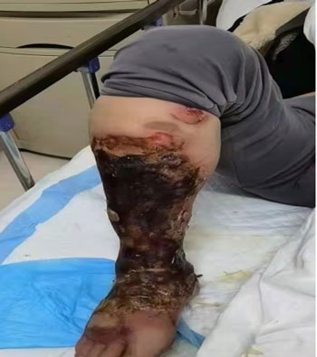 202203291139354849.jpg 1.jpg