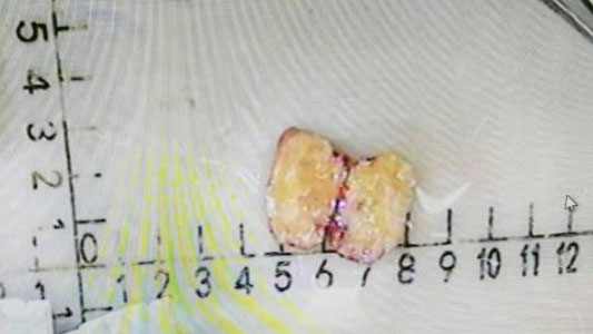 202203291143176494.jpg 202203291143176494.jpg