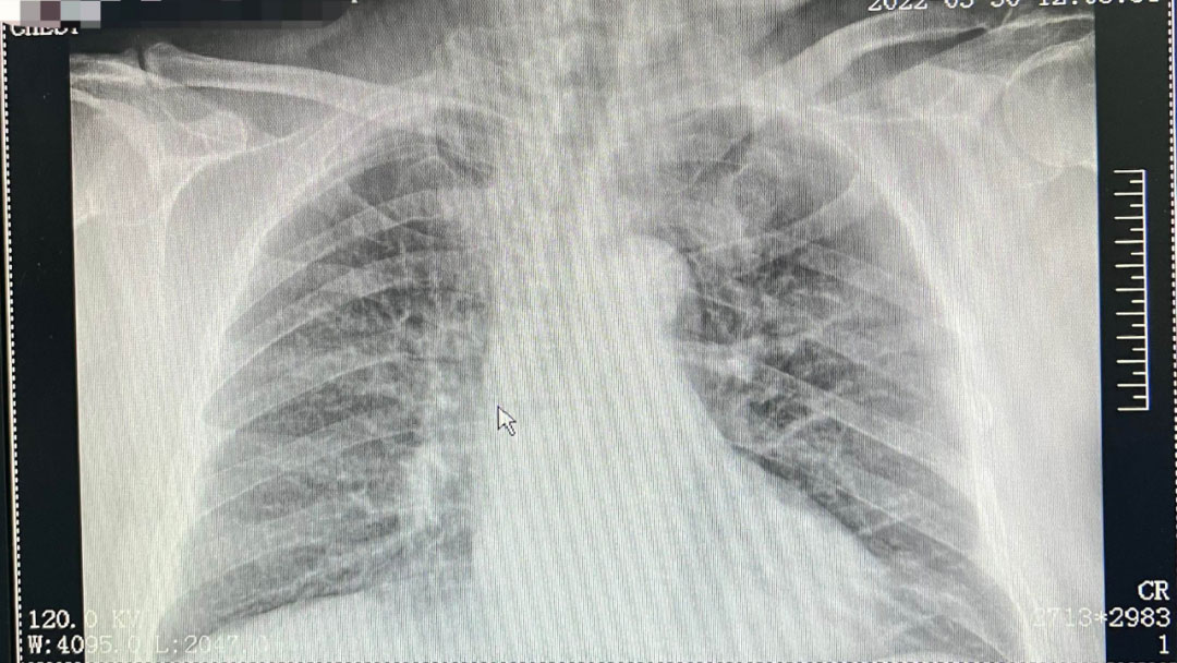 202203310903137676.jpg 2.jpg