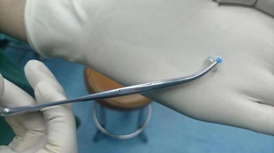 又一阴道塞“异物”的小患者！提醒家长需注意！