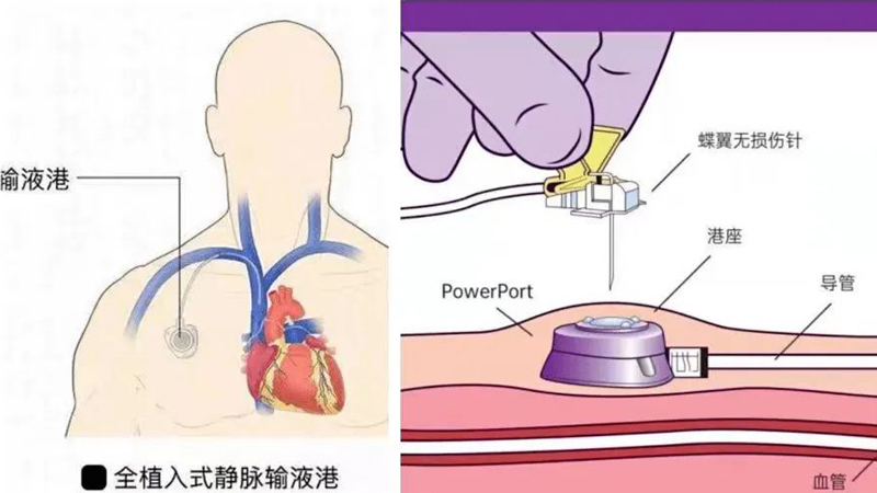 202305171102461332.jpg 微信图片_20230517110648.jpg