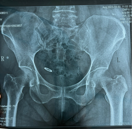 202311171651097122.jpg 11.jpg