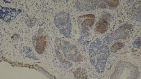 小心！！！皮肤刺客