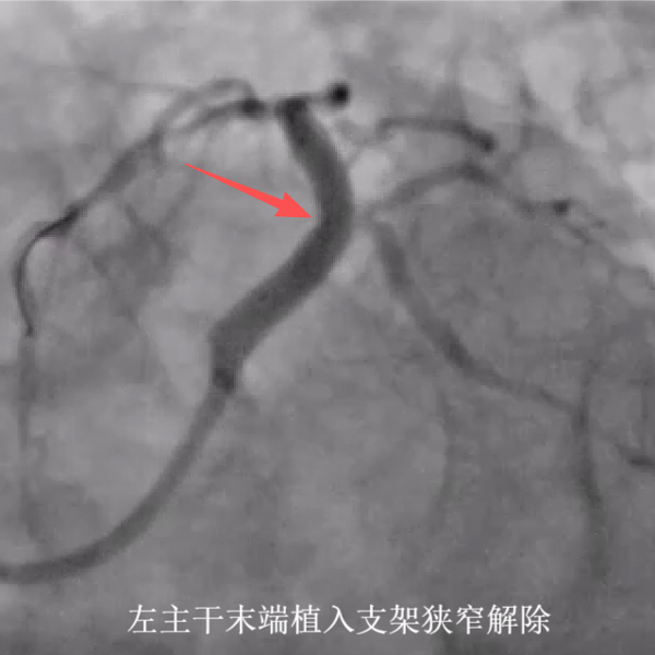 202511241023271064.jpg 202511241023271064.jpg