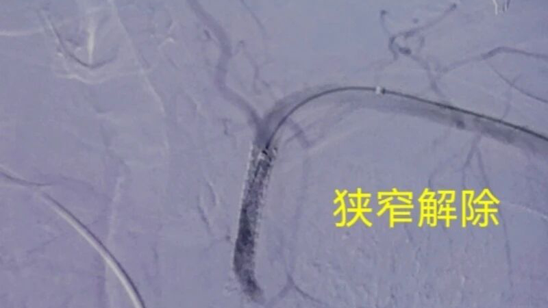 202603170939194557.jpg 202603170939194557.jpg