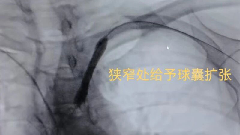 202603170939196509.jpg 202603170939196509.jpg