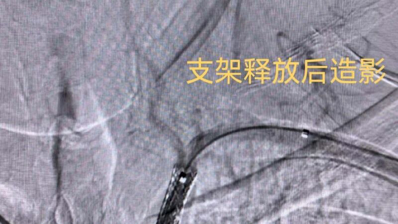 202603170939199652.jpg 202603170939199652.jpg